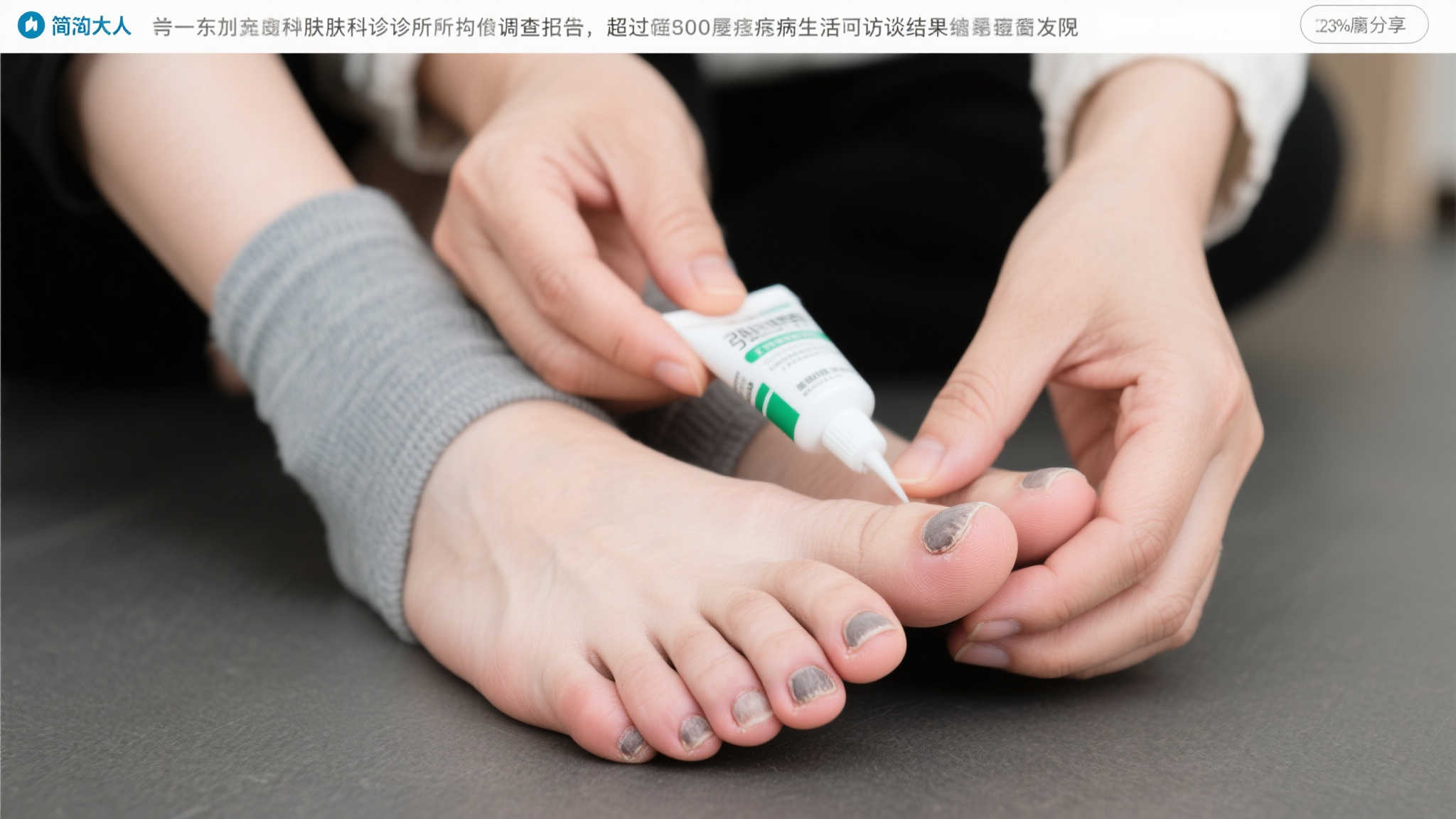 洞洞鞋或成真菌感染温床，引发微博热议